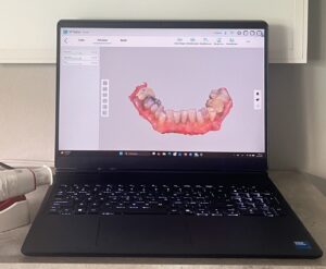 Ενδοστοματικός σαρωτής